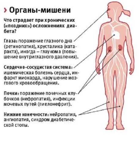 Уникальное влияние Диабетона на сердце и сосуды позволяет снизить риск развития поздних осложнений СД Уникальное влияние Диабетона на сердце и сосуды позволяет снизить риск развития поздних осложнений СД