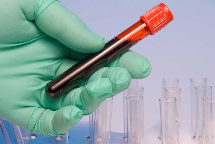 Сахар венозной крови