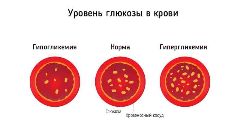 Уровень глюкозы в крови