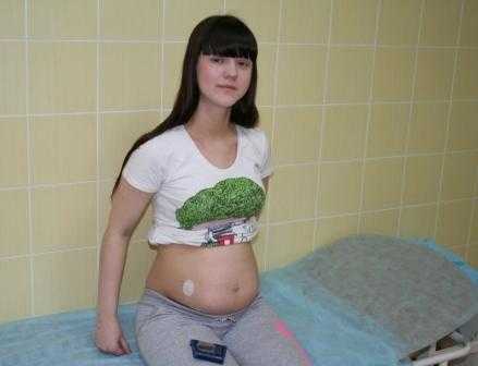 Установка беременным Установка беременным