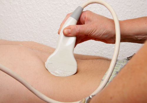 УЗИ брюшной полости