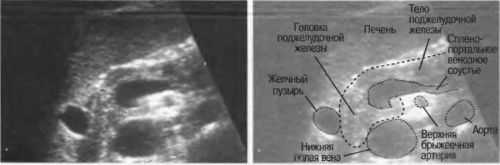 Поджелудочная железа на УЗИ