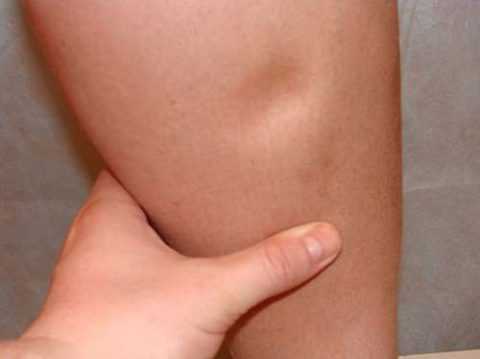 В чем опасность проявления.