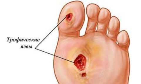 В чем опасность такого поражения. В чем опасность такого поражения.