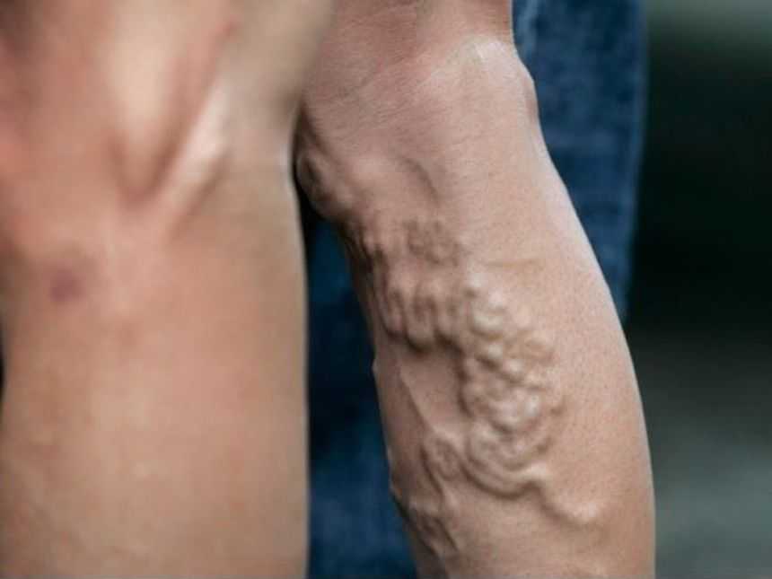 Патологии, связанные с инсулином