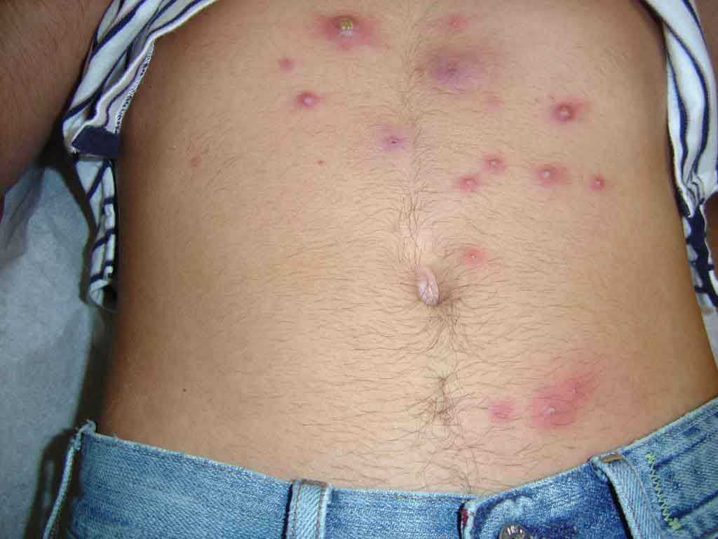 Третья группа