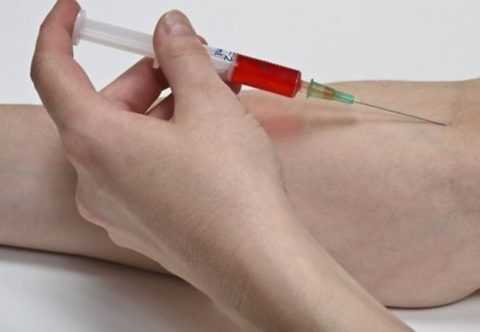Забор крови производится трижды.