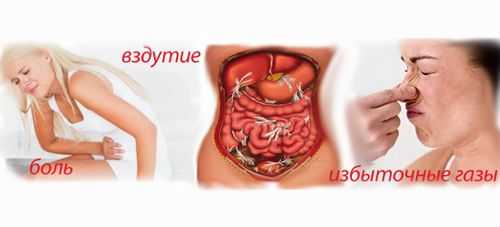 Основные признаки запора